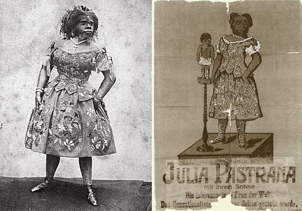 Юлия Пастарна по прозвищу женщина-горилла. \ Фото: 2.bp.blogspot.com.