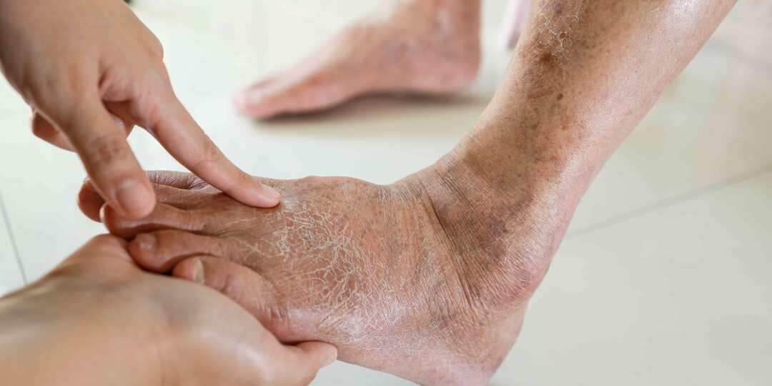 6 тревожных изменений на ногах после 60