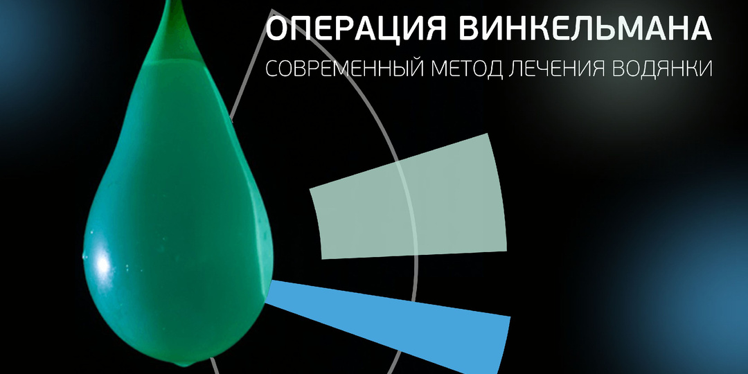 Операция Винкельмана. Когда водянку яичка нужно оперировать?