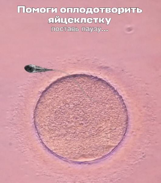 Помоги оплодотворить яйцеклетку! Жми на паузу!