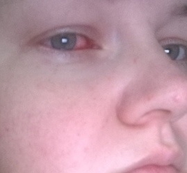 Это только начало моих мучений...