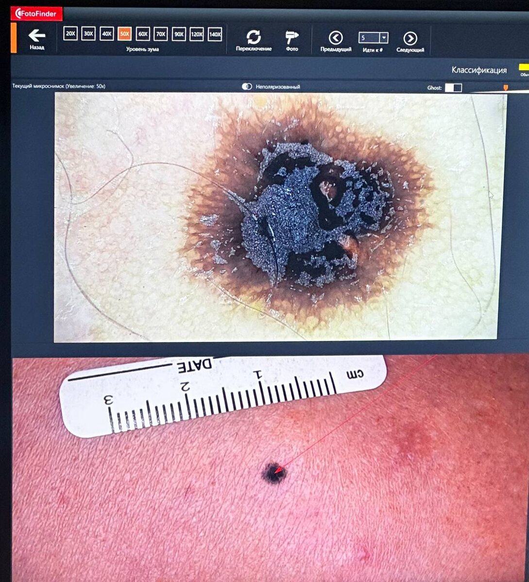 Из множества родинок фотофайдеру не порнавилась эта. Так она выглядит если добавить немного зума