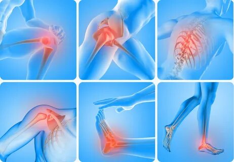 Что разрушает суставы и что их сохраняет