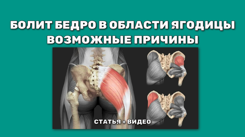 Болит бедро в области ягодицы. Что может быть?