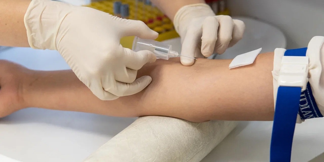 Как отличить гормональный сбой от реакции организма на образ жизни