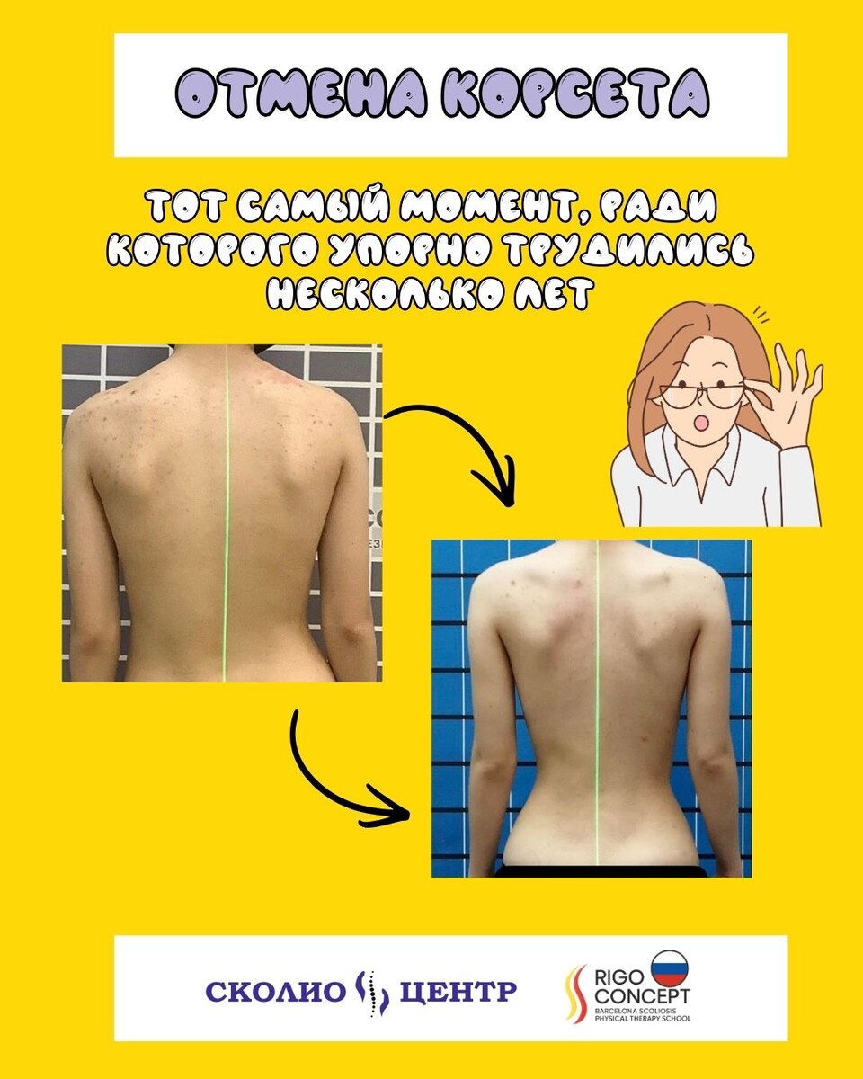 Отмена корсета — тот самый момент, ради которого упорно трудились несколько лет