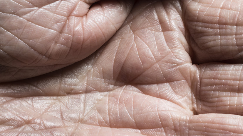 Не спасает даже крем: как определить, что кожа обезвожена? Объяснила дерматолог