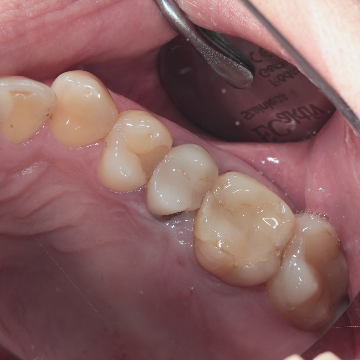 Состояние до