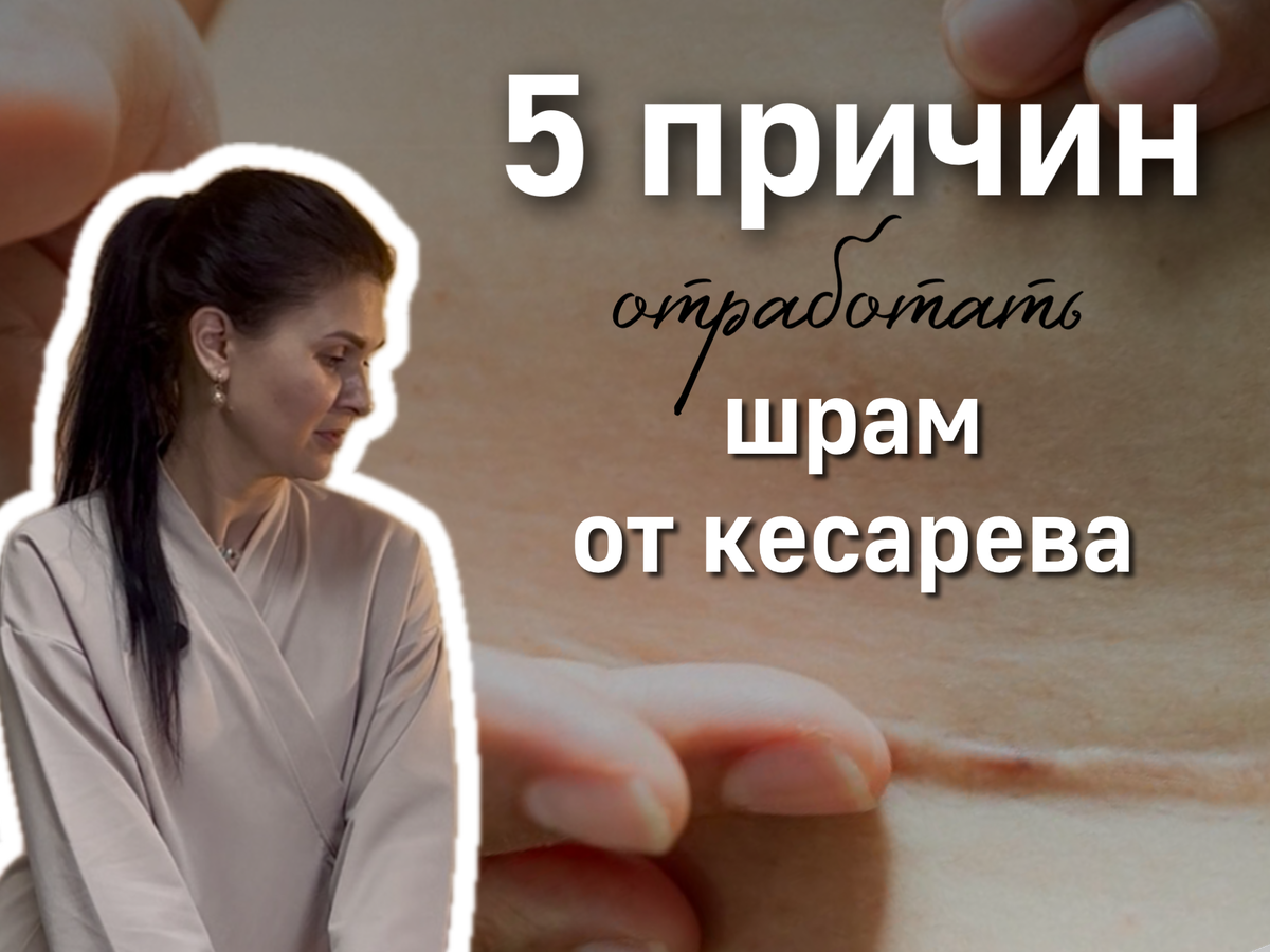 Работа со шрамом после кесарева может стать важным шагом на пути к восстановлению гармонии тела