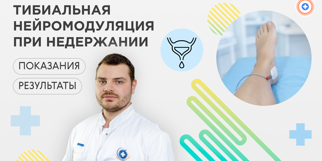 Тибиальная нейромодуляция при недержании: кому показана и какие результаты ждать