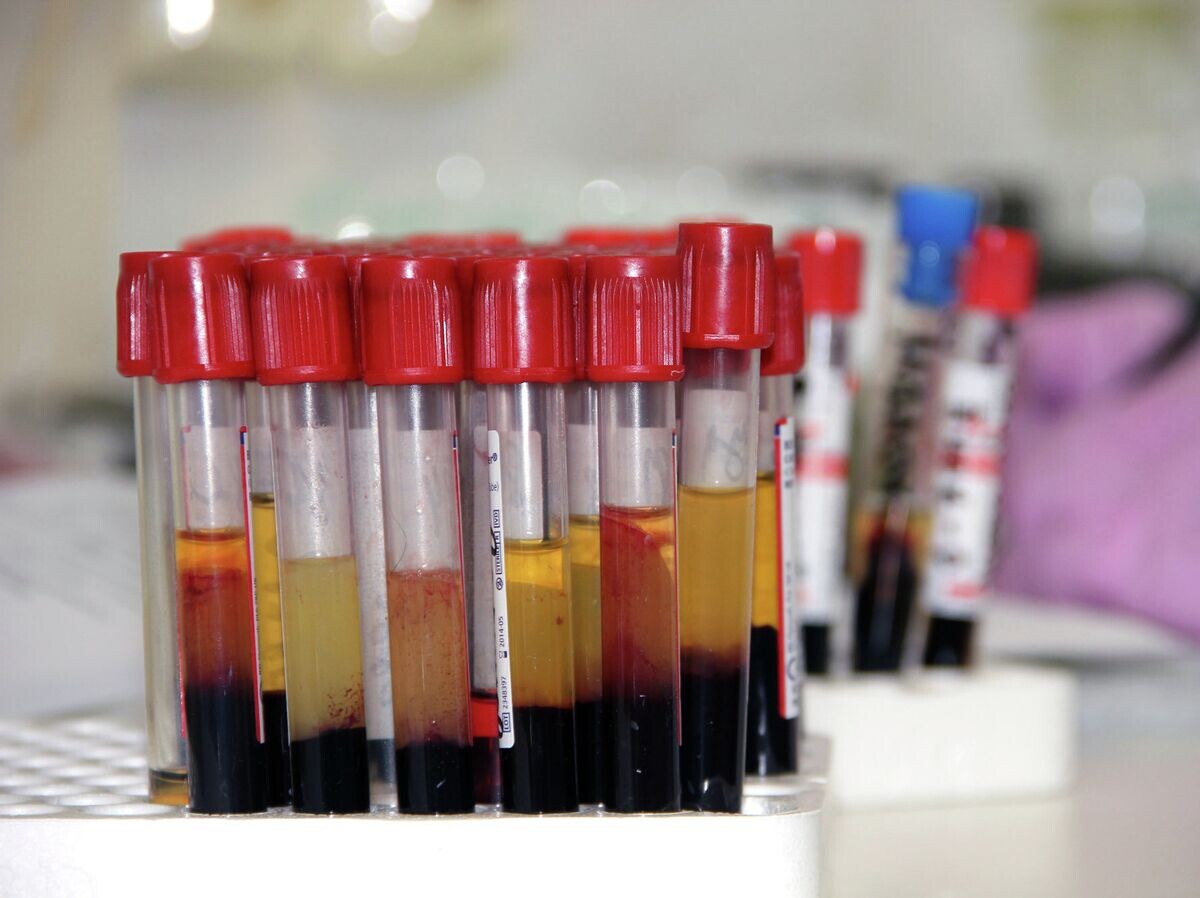    Ампулы с кровью | © РИА Новости / Элеонора Черная