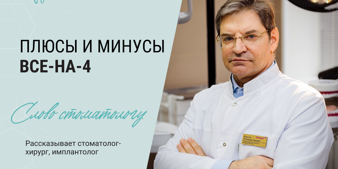 5 плюсов и 5 минусов Все-на-4