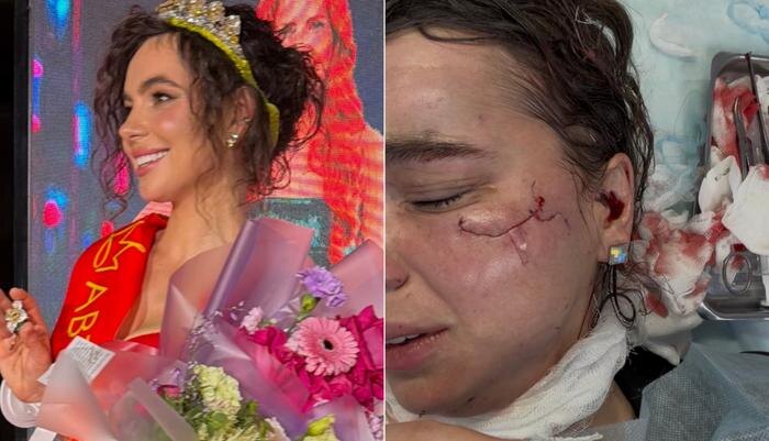 Надежда Шустова до и после трагедии. Обложка © VK / Надежда Шустова