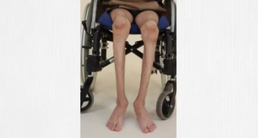 Фото: НМИЦ ТО им. акад. Г.А. Илизарова Минздрава РФ