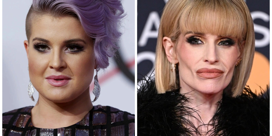 Они просто хотели быть молодыми и красивыми: знаменитости, переборщившие с пластикой