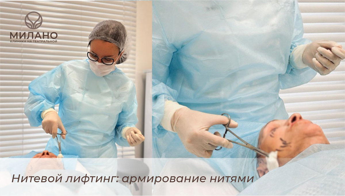 Нитевой лифтинг: армирование нитями