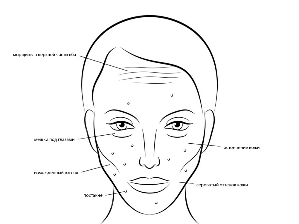 Признаки "Сахарного лица"