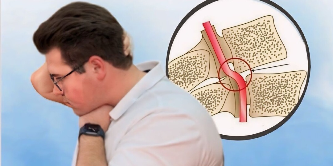 Простой тест на сосуды шеи: как самостоятельно оценить риск инсульта