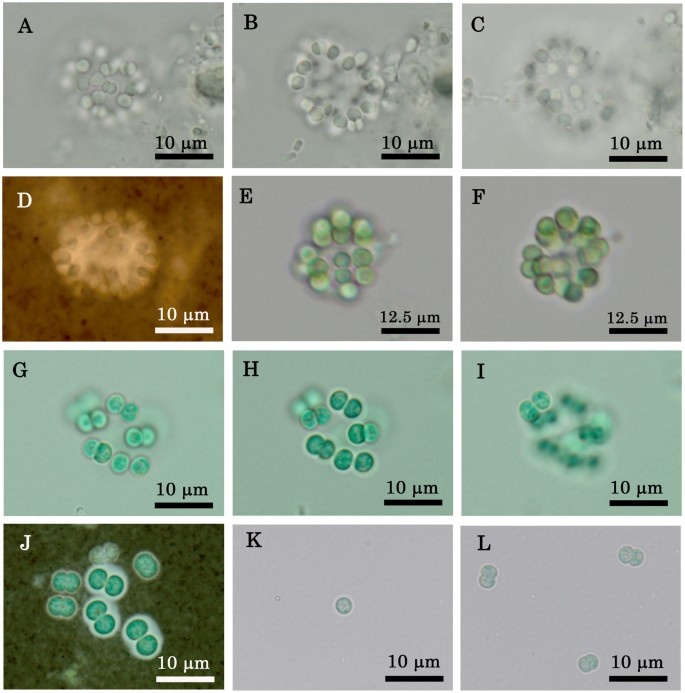 Цианобактерии, продуцирующие геосмин. Очень маленькие.