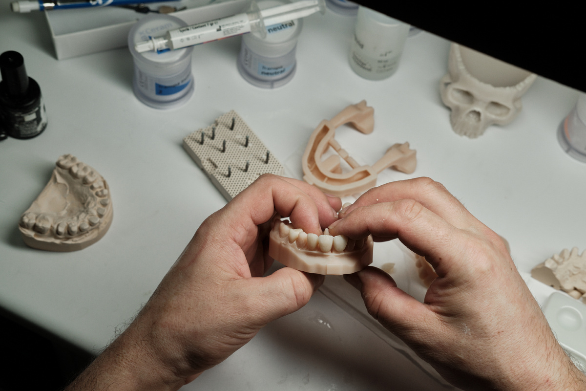 Собственная зуботехническая лаборатория — путь к низкой цене и качеству. 