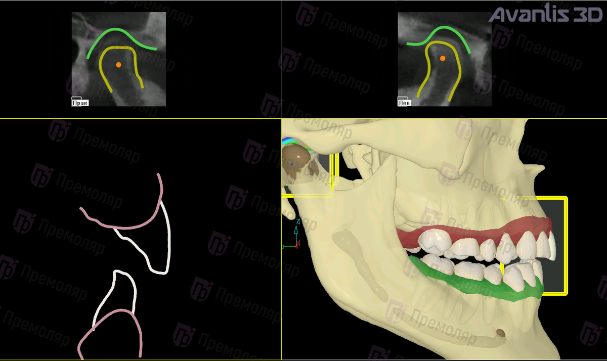 Стоматология Премоляр