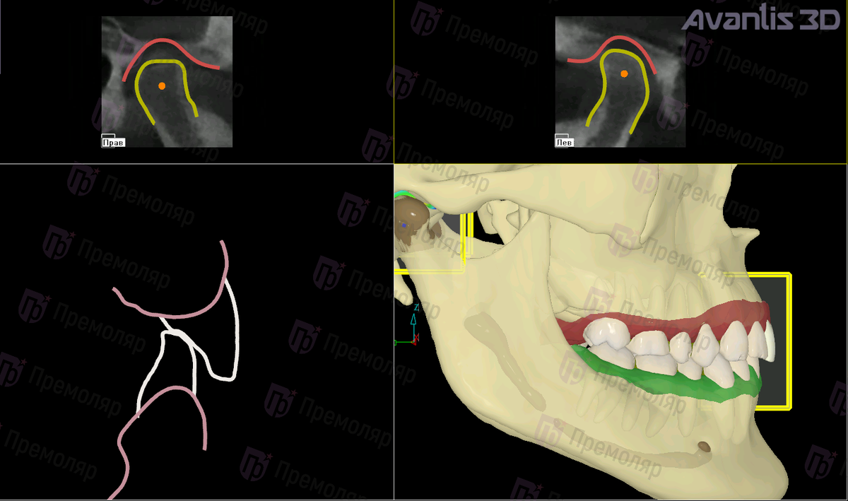 Стоматология Премоляр