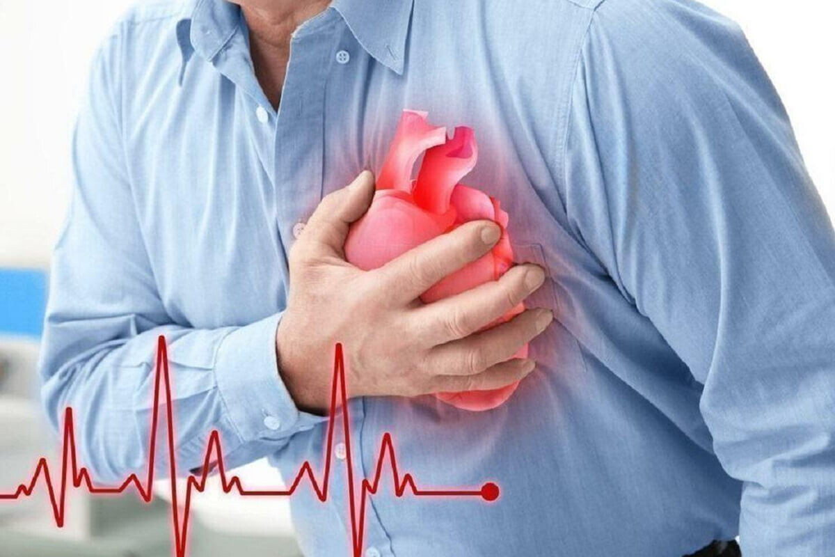 Ученые назвали возраст, когда у мужчин резко возрастает риск инфаркта