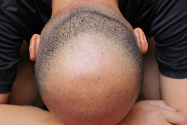 ansoz/Shutterstock/FOTODOM   📷