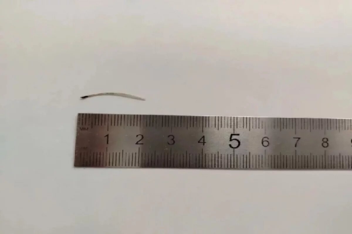    Липчанку чуть не убила крошечная косточка от рыбы