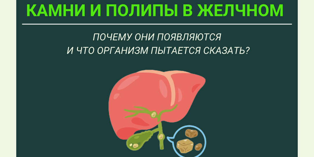 Камни и полипы в желчном. Почему они появляются и что организм пытается сказать?