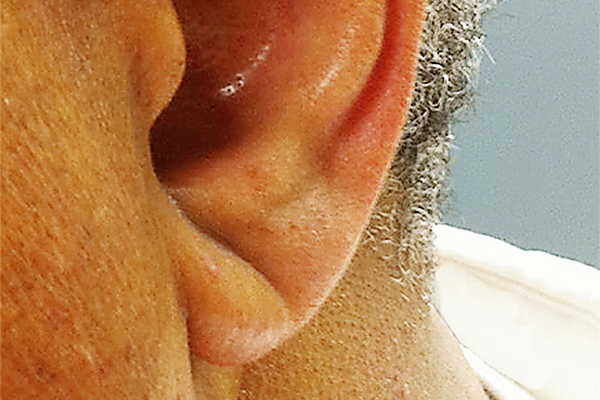 Знак Фрэнка