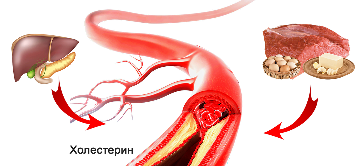 Едим и болеем.