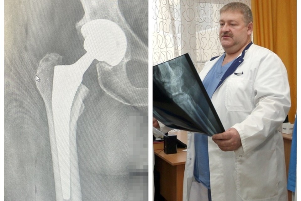    Медики из Кургана помогли восстановить подвижность пациентке из Мариуполя. Фото: НМИЦ ТО имени академика Г.А. Илизарова