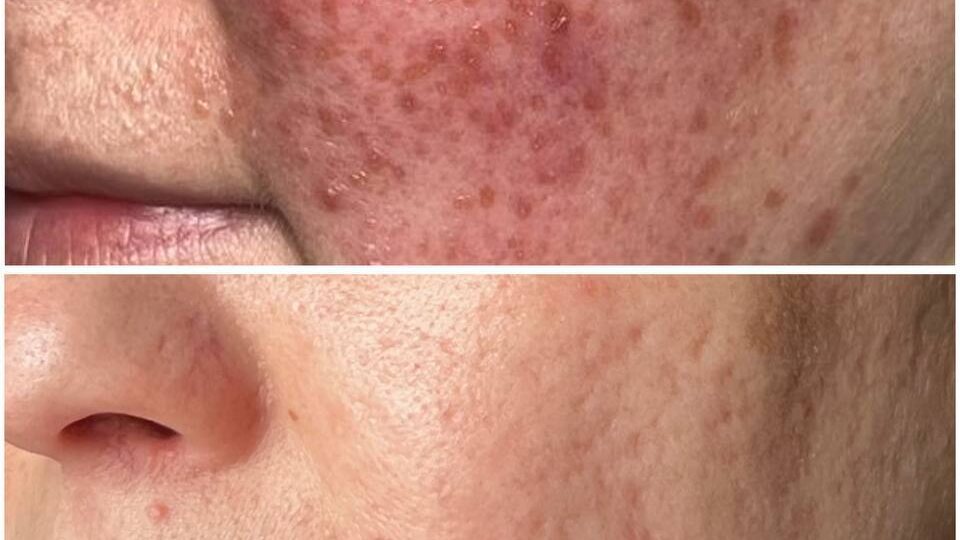 💢 Выраженный отёк лица