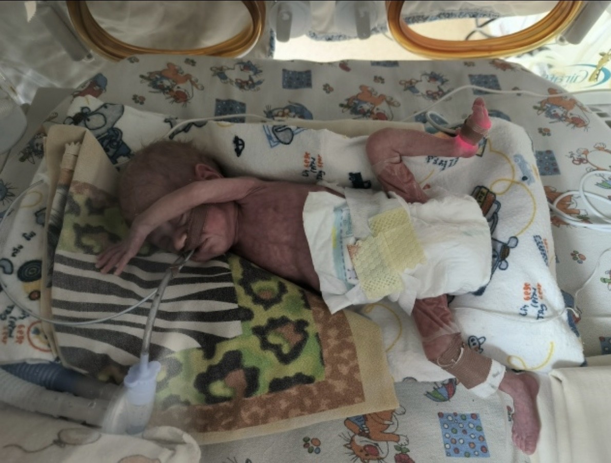 Полина в ОРИТН