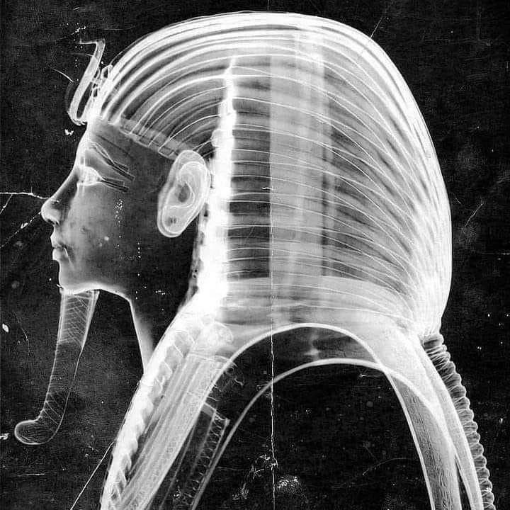 Рентгеновский снимок маски "египетского фараона Тутанхамона".