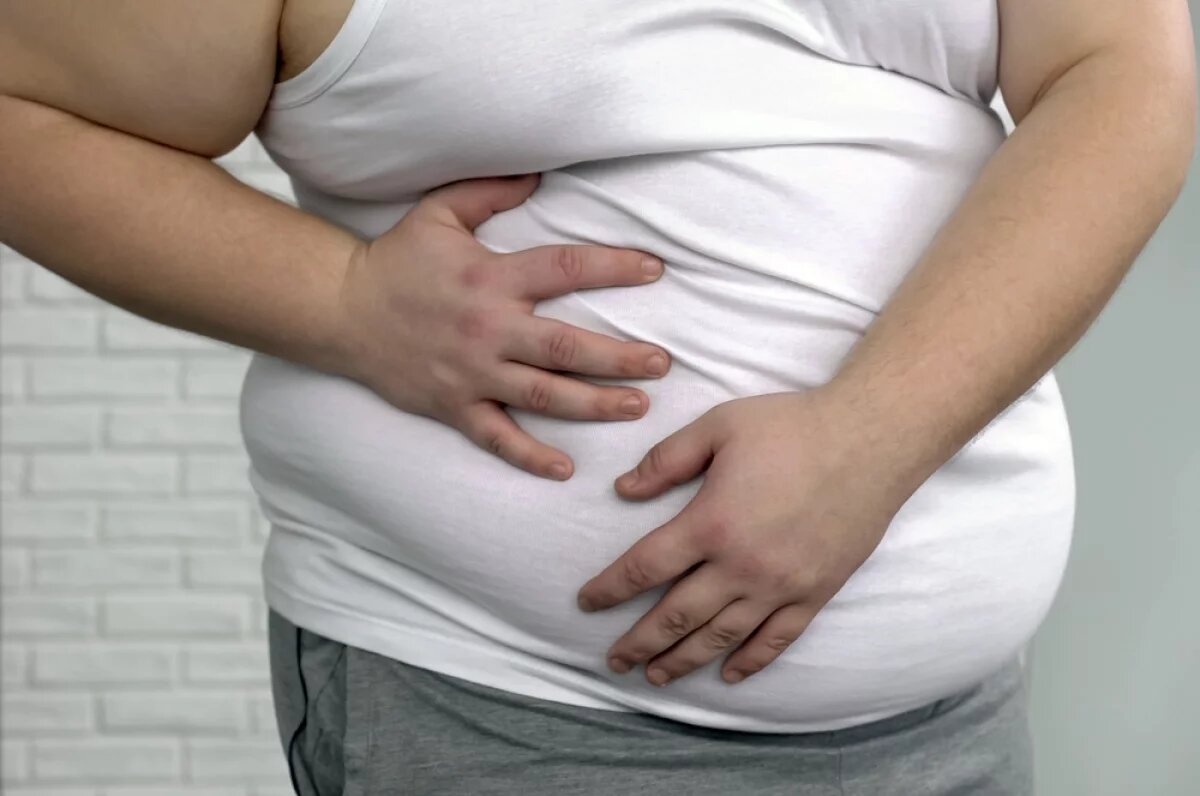    Врач Шмидт: ожирение может сократить продолжительность жизни