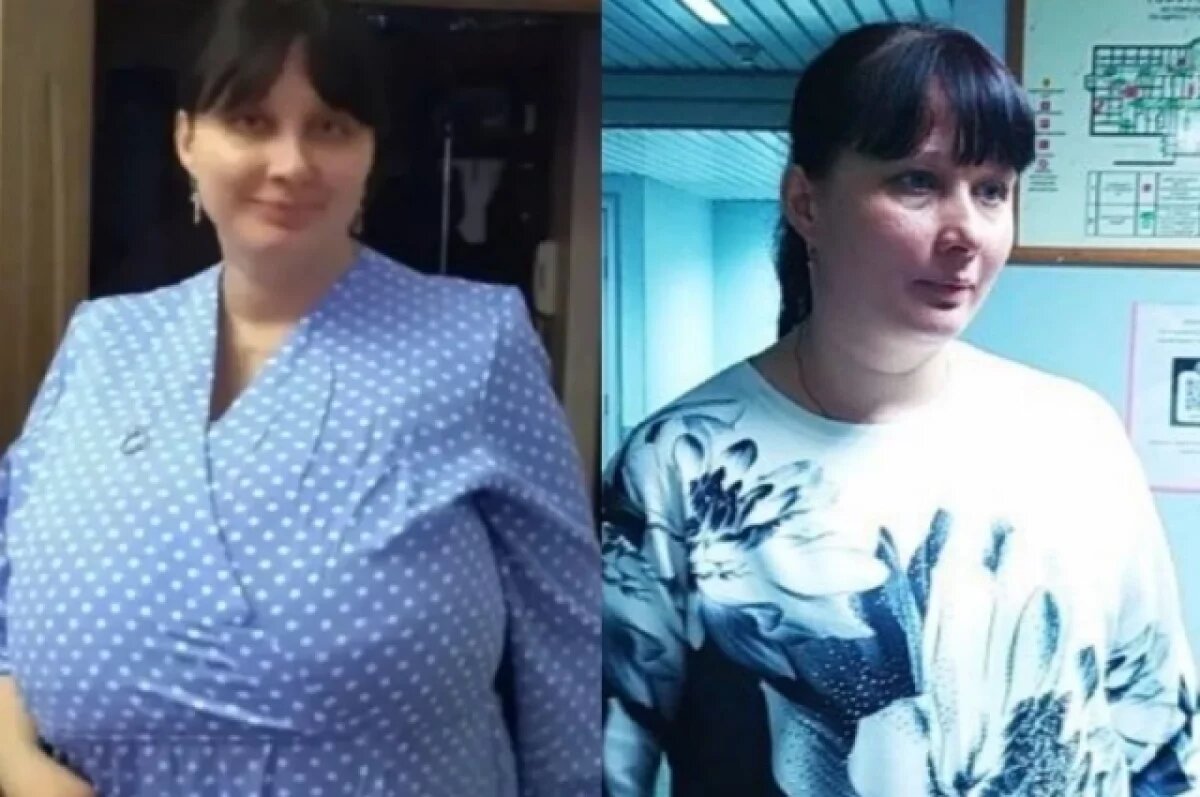    Грудь Екатерины уменьшилась с 22 до 2 размера