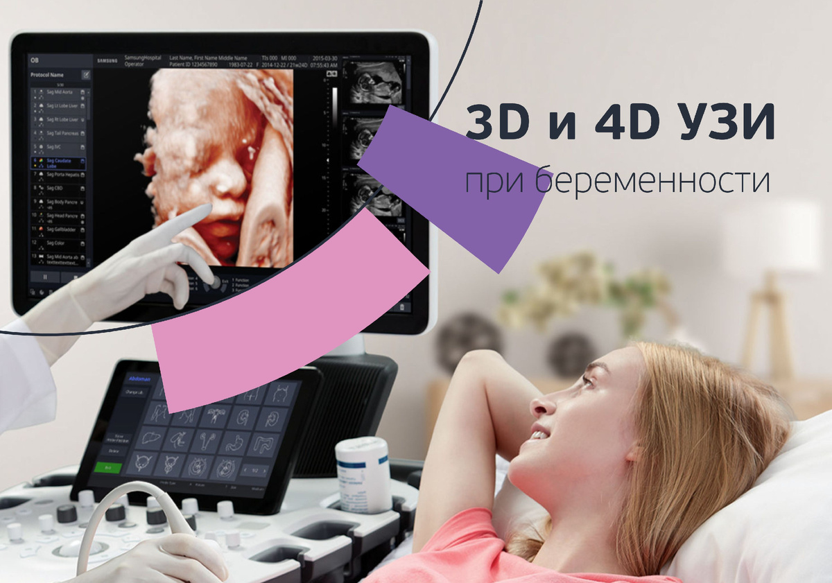 3D и 4D УЗИ при беременности. Зачем нужно, что показывает и в какие сроки лучше делать