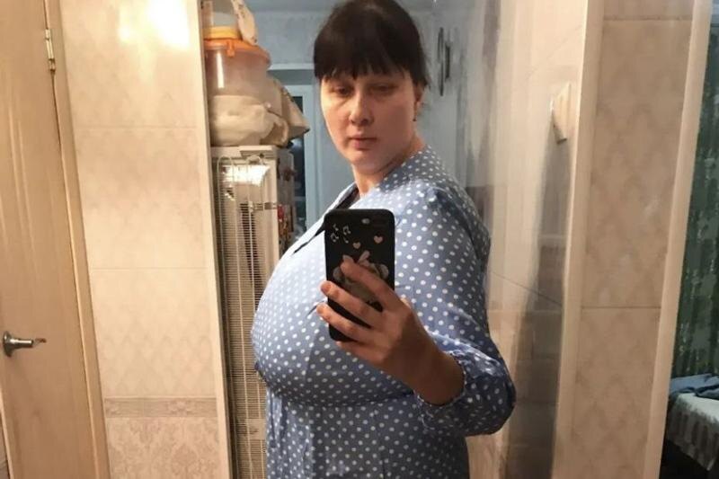    ЧОКБ. Екатерина до операции