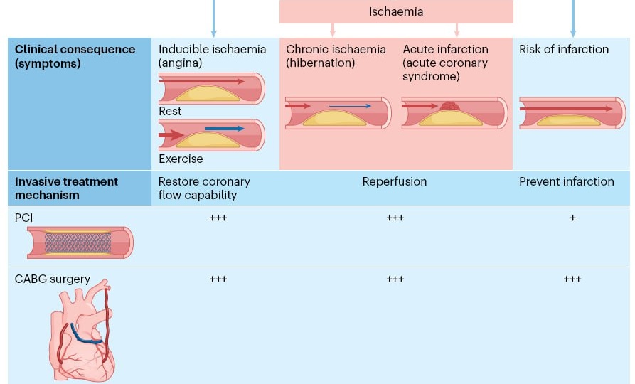 Главный вывод 2026 года: Лечим не ангиограмму, а пациента