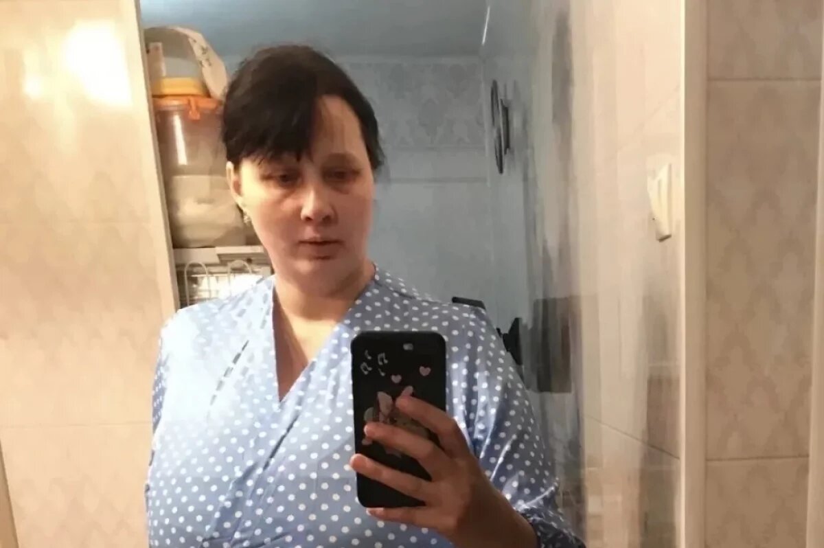    До операции Екатерина носила грудь 22 размера, которая значительно ухудшала жизнь