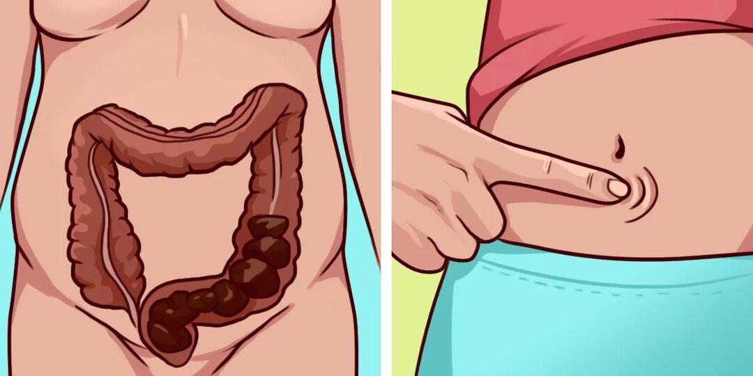 Запор: когда «большой поход» отменяется. Что класть в тарелку, чтобы наладить стул без таблеток