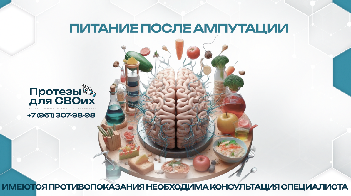 Ростов-на-Дону, ул. Таганрогская, 33, "Протезы для СВОих"