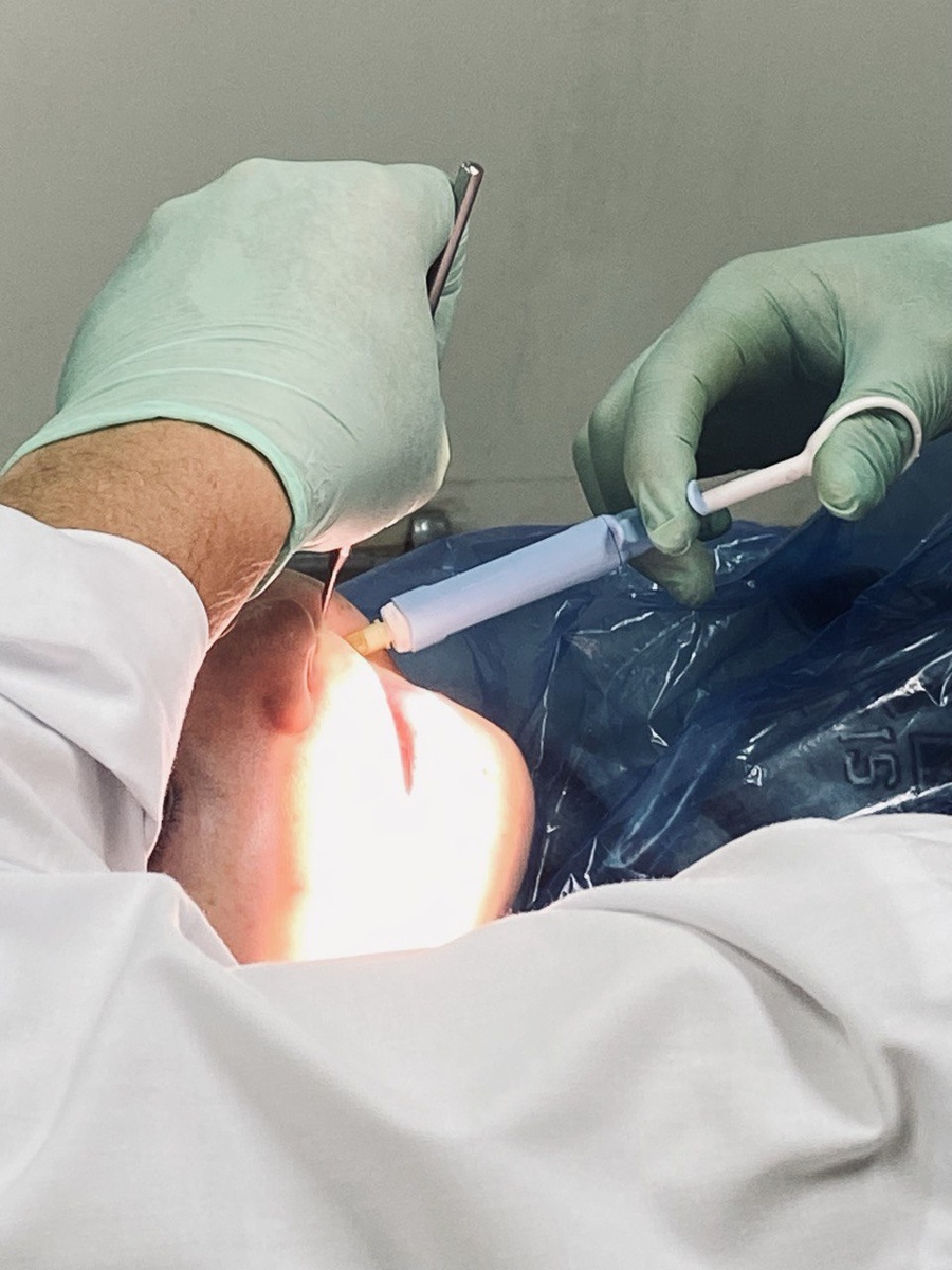 Делаем анестезию.