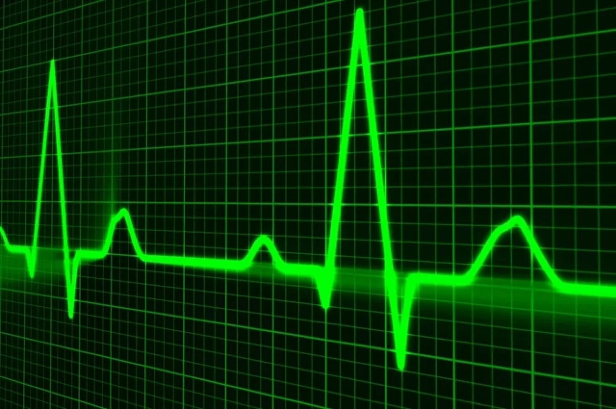    Жизнь гражданина Турции с острым инфарктом спасли врачи в Волгограде