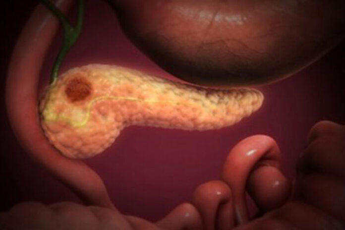    Репортаж из 2032 года: Как стресс стал главным канцерогеном, нейро-онкология произвела революцию в лечении рака мозга, а офисное рабство ушло в прошлое.