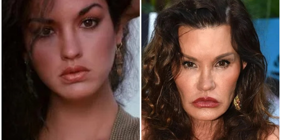 Хотели сохранить юность, получили кошмар: 6 знаменитостей, испортивших собственную внешность