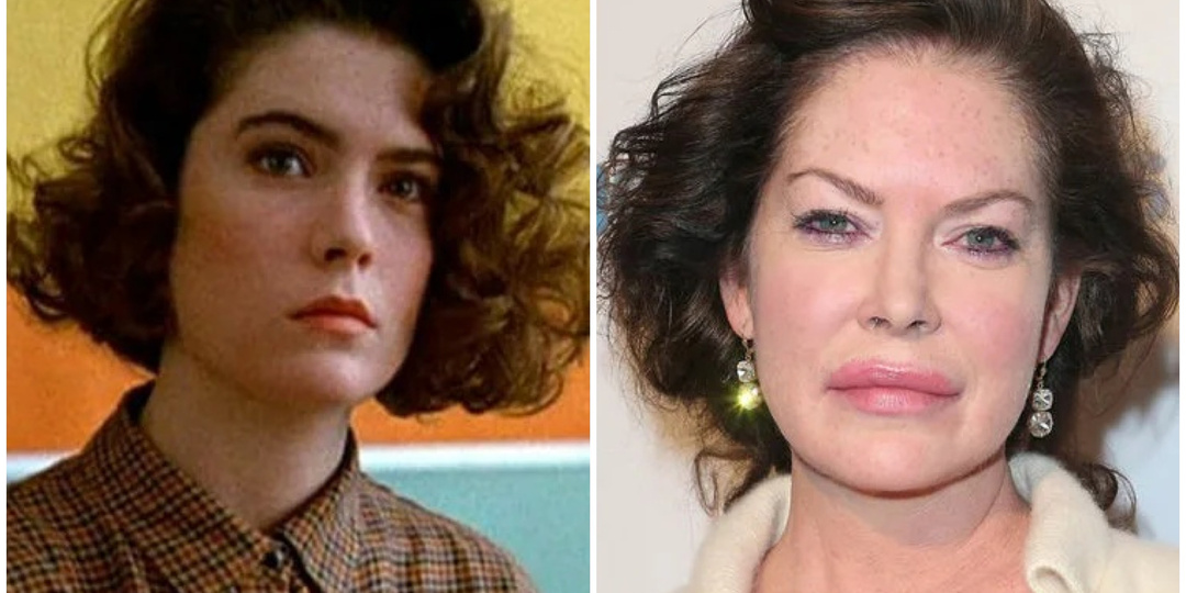 Хотели сохранить юность, получили непонятно что: 6 знаменитостей, испортивших собственную внешность