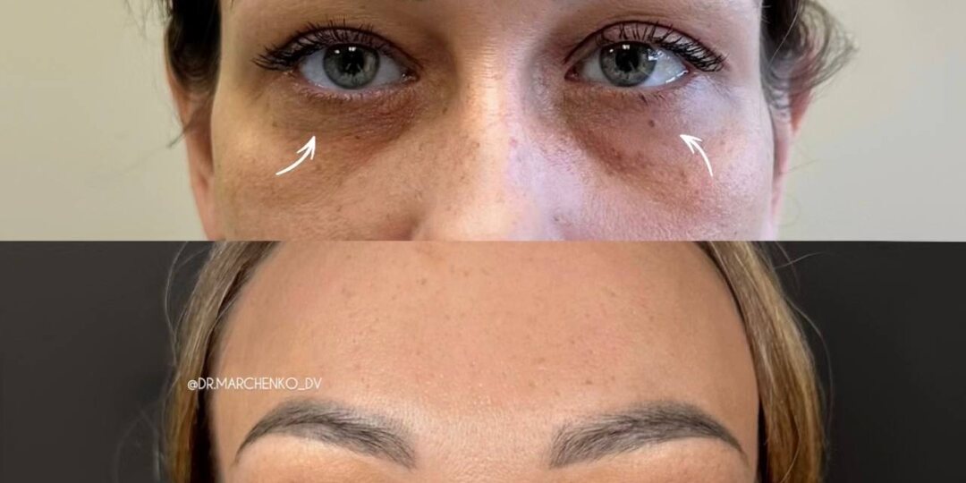 ✨ 1 месяц + 1 неделя